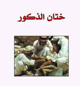 ختان الذكور