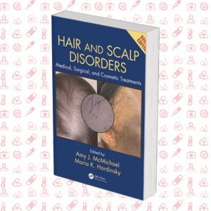 Hair And Scalp Disorders